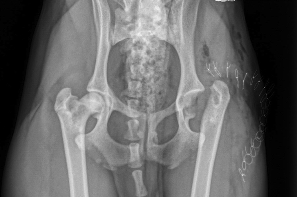 Nécrose avasculaire de la tête fémorale