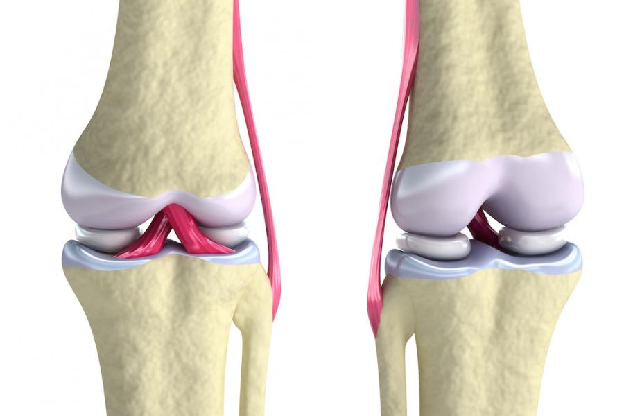 Rupture du ligament croisé crânial (RLCC) chez le chien